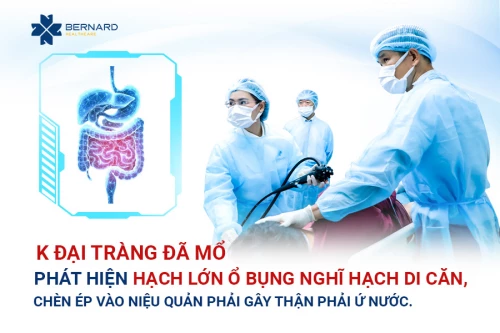 Đau hông lưng kéo dài, người đàn ông phát hiện hạch lớn nghi di căn chèn ép thận